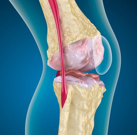 Αρθροπλαστική γόνατος : Κόστος - Τιμή χειρουργείου